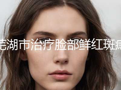 芜湖市治疗脸部鲜红斑痣价格表公布(8月-3月治疗脸部鲜红斑痣均价为：1082元)