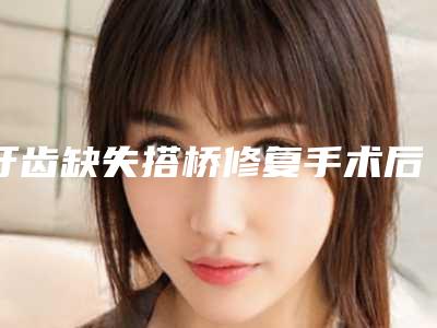 牙齿缺失搭桥修复手术后效果自然吗
