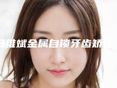 丑维斌金属自锁牙齿矫正术后护理四大注意事项