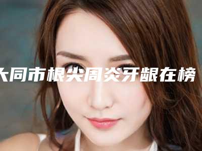 大同市根尖周炎牙龈在榜清单前十位提前出炉-大同市根尖周炎牙龈口腔医生