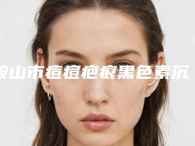 鞍山市痘痘疤痕黑色素沉淀去除价格(费用)清单曝光,在线查-鞍山市痘痘疤痕黑色素沉淀去除手术价格要准备多少